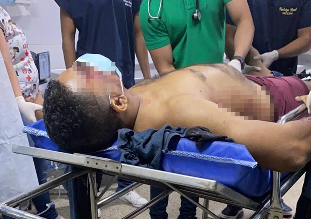 Policial Civil é baleado após reagir a assalto em bar