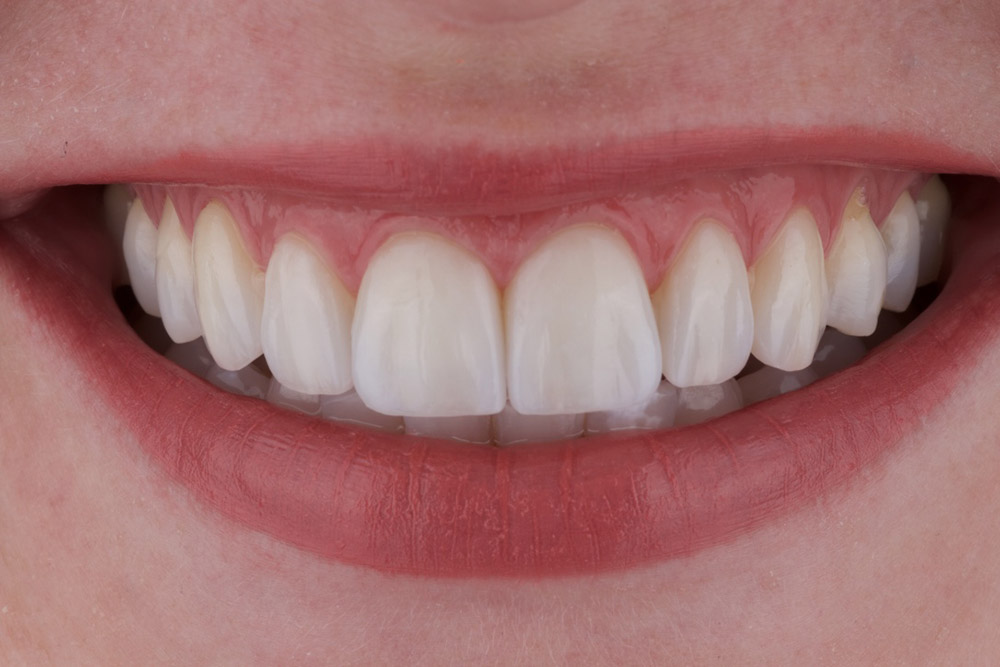 Odontologia Estética